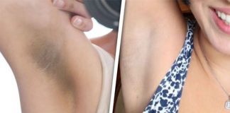 Koltuk Altı Kararması Koltuk Altı Kararması