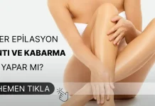 Lazer Sonrası Kaşıntı Lazer Sonrası Kaşıntı