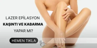 Lazer Sonrası Kaşıntı Lazer Sonrası Kaşıntı